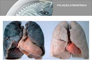 POLUIÇÃO ATMOSFÉRICA 