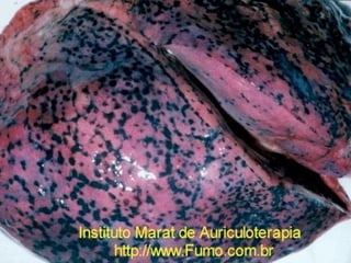 POLUIÇÃO ATMOSFÉRICA 