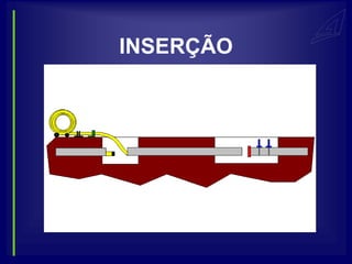 INSERÇÃO
 