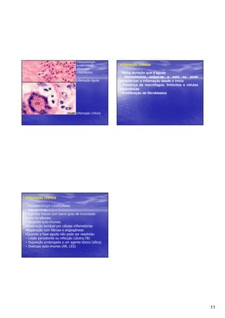 11 
Histopatologia 
evidenciando 
diferentes 
inflamações. 
Inflamação Aguda 
Inflamação Crônica 
Inflamação crônica 
• Maior duração que a aguda 
• Normalmente segue-se a esta ou pode 
caracterizar a inflamação desde o início 
• Presença de macrófagos, linfócitos e células 
plasmáticas 
• Proliferação de fibroblastos 
Inflamação crônica 
• Mycobacterium tuberculosis; 
• Alguns vírus; 
• Agentes físicos com baixo grau de toxicidade 
como na silicose; 
• Reações auto-imunes. 
•Destruição tecidual por células inflamatórias 
•Reparação com fibrose e angiogênese 
•Quando a fase aguda não pode ser resolvida: 
– Lesão persistente ou infecção (úlcera,TB) 
– Exposição prolongada a um agente tóxico (sílica) 
– Doenças auto-imunes (AR, LES) 
