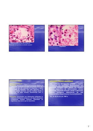 7 
Corte histológico de um vaso sanguíneo: 
Marginação de leucócitos no endotélio vascular! 
Diapedese! 
Inflamação aguda: 
Células imunológicas: 
Neutrófilos: granulócitos típicos de fenômenos agudos da 
inflamação, presentes em maior quantidade nesta fase 
devido ao seu alto potencial de diapedese e rápida 
velocidade de migração. Têm ação fagocítica e, se 
mortos, podem provocar necrose tecidual devido a 
liberação de suas enzimas lisossômicas para o 
interstício. 
Eosinófilos: encontrados nas inflamações subagudas ou 
relativas a fenômenos alérgicos e em alguns processos 
neoplásicos. Também possuem capacidade de 
fagocitose, mas menor que os neutrófilos. 
CITOCINAS PRÓ-INFLAMATÓRIAS 
São moléculas de natureza protéica, a maioria 
sintetizada por leucócitos, desempenham sua 
atividade biológica após ligação em receptor 
celular específico de determinadas células 
teciduais, induzindo ativação celular e diferentes 
efeitos biológicos dependendo da sua 
característica bioquímica ou imunomoduladora. 
Ex.: IL-1, IL-6, IL-8, TNF- 
 