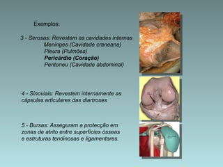 3 - Serosas: Revestem as cavidades internas Meninges (Cavidade craneana)   Pleura (Pulmões)   Pericárdio (Coração)   Peritoneu (Cavidade abdominal) 4 - Sinoviais: Revestem internamente as cápsulas articulares das diartroses 5 - Bursas: Asseguram a protecção em zonas de atrito entre superfícies ósseas  e estruturas tendinosas e ligamentares. Exemplos: 