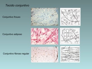Tecido conjuntivo Conjuntivo frouxo Conjuntivo adiposo Conjuntivo fibroso regular 