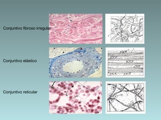 Conjuntivo fibroso irregular Conjuntivo elástico Conjuntivo reticular 