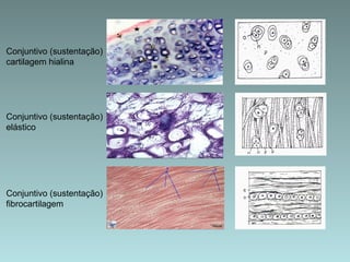Conjuntivo (sustentação) cartilagem hialina Conjuntivo (sustentação) elástico  Conjuntivo (sustentação) fibrocartilagem 
