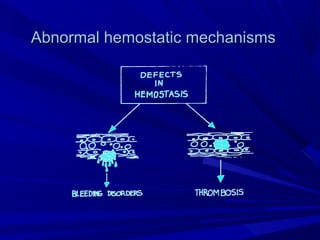 Abnormal hemostatic mechanismsAbnormal hemostatic mechanisms
 