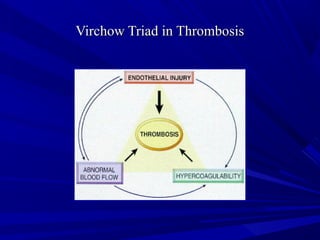 Virchow Triad in ThrombosisVirchow Triad in Thrombosis
 