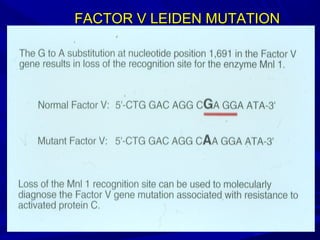 FACTOR V LEIDEN MUTATIONFACTOR V LEIDEN MUTATION
 