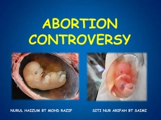 ABORTION CONTROVERSY NURUL HAIZUM BT MOHD RAZIF		 SITI NUR ARIFAH BT SAIMI 