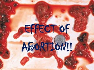 Result: will not involve any stitches and so there is no wound. Most healthy women can go home the same day.ABORTION CONTROVERSY.