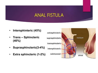 Laser Surgery in Proctology.pptx