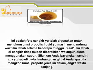 Ini adalah foto cangkir yg telah digunakan untuk mengkonsumsi propolis liquid yg masih mengandung wax/lilin lebah selama beberapa minggu. Sisa2 lilin lebah di cangkir tidak mudah dibersihkan walaupun dicuci menggunakan sabun. Silahkan Anda bayangkan sendiri, apa yg terjadi pada lambung dan ginjal Anda apa bila mengkonsumsi propolis jenis ini dalam jangka waktu panjang. Cangkir  yang dipakai untuk mengkonsumsi  Propolis Liquid  Perhatikan Foto di bawah ini !!!! 