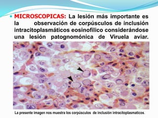  MICROSCOPICAS: La lesión más importante es
 la      observación de corpúsculos de inclusión
 intracitoplasmáticos eosinofilico considerándose
 una lesión patognomónica de Viruela aviar.




 La presente imagen nos muestra los corpúsculos de inclusión intracitoplasmaticos.
 