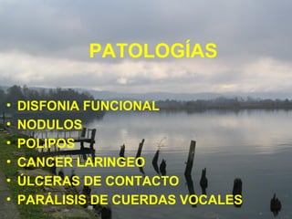 PATOLOGÍAS DISFONIA FUNCIONAL NODULOS POLIPOS CANCER LARINGEO ÚLCERAS DE CONTACTO PARÁLISIS DE CUERDAS VOCALES
