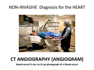 NON-INVASIVE Diagnosis for the HEART 
CT ANGIOGRAPHY (ANGIOGRAM) 
blood-vessel X-ray: an X-ray photograph of a blood vessel 
 