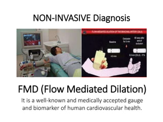 NON-INVASIVE Diagnosis 
FMD (Flow Mediated Dilation) 
It is a well-known and medically accepted gauge 
and biomarker of human cardiovascular health. 
 