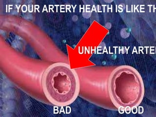 IF YOUR ARTERY HEALTH IS LIKE THIS 
UNHEALTHY ARTERY! 
BAD GOOD 
 
