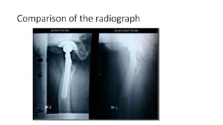 Scadding Radiological Classification Production and control of scatter radiation (beam | PPTX