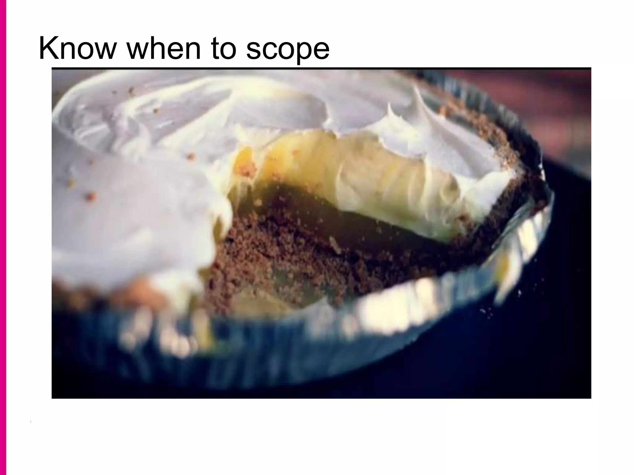 Know when to scope
 