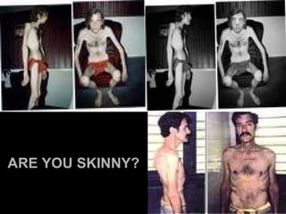 ARE YOU SKINNY? 