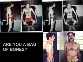 ARE YOU A BAG OF BONES? 