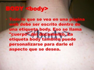 BODY <body> 
• Todo lo que se vea en una página 
web debe ser escrito dentro de 
una etiqueta body. Eso se llama 
"cuerpo" del documento. La 
etiqueta body también puede 
personalizarse para darle el 
aspecto que se desea. 
 