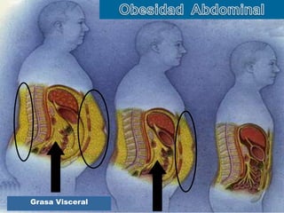 Grasa Visceral 
 
