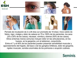 Período de incubación de 2 a 26 días (un promedio de 10 días). Inicio súbito de fiebre, rigor, mialgia y dolor de cabeza en 75 a 100% de los pacientes, tos seca (25 a 35% de los casos), náuseas, vómitos y diarrea (50% de los casos).  Otros síntomas menos comunes incluyen dolor en las articulaciones, en los huesos, en la garganta y en el abdomen, conjuntivitis. Entre el 7 y el 40% de los pacientes pueden presentar sensibilidad muscular y agrandamiento del hígado, del bazo o de los ganglios linfáticos, dolor de garganta, rigidez muscular, sonidos anormales de los pulmones o erupción cutánea. 