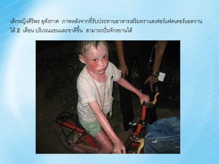 เด็กหญิงศิริพร อุทงกาศ ภาพหลังจากที่รับประทานอาหารเสริมทรานสเฟอร์แฟคเตอร์แอดวาน
                  ั
ได้ 2 เดือน บริเวณแขนและขาดีขึ้น สามารถปั่นจักรยานได้
 