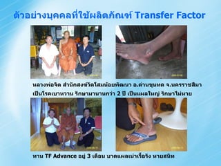 ตัวอย่างบุคคลที่ใช้ผลิตภัณฑ์ Transfer Factor




    หลวงพ่อจิต สานักสงฆ์วัดโสมน้อยพัฒนา อ.ด่านขุนทด จ.นครราชสีมา
    เป็นโรคเบาหวาน รักษามานานกว่า 2 ปี เป็นแผลใหญ่ รักษาไม่หาย




    ทาน TF Advance อยู่ 3 เดือน บาดแผลเน่าเรื้อรัง หายสนิท
 