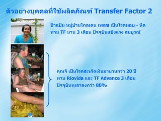 ตัวอย่างบุคคลที่ใช้ผลิตภัณฑ์ Transfer Factor 2
             ป้าแป้น หมูบ้านโกลเดน เพลซ เป็นโรคหอบ - หืด
                        ่
             ทาน TF นาน 3 เดือน ปัจจุบันแข็งแรง สมบูรณ์




               คุณจี เป็นโรคสะเก็ดเงินมานานกว่า 20 ปี
               ทาน Riovida และ TF Advance 3 เดือน
               ปัจจุบันทุเลาลงกว่า 80%
 