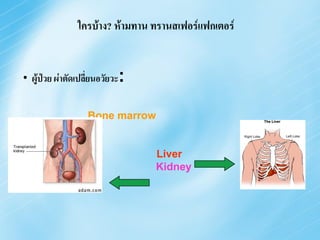 ใครบ้าง? ห้ามทาน ทรานสเฟอร์แฟกเตอร์


• ผู้ป่วย ผ่าตัดเปลี่ยนอวัยวะ:


                   Bone marrow


                                 Liver
                                 Kidney
 