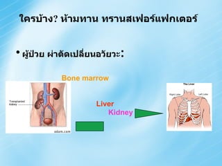 ผู้ป่วย ผ่าตัดเปลี่ยนอวัยวะ : Bone marrow Liver  Kidney ใครบ้าง ?  ห้ามทาน ทรานสเฟอร์แฟกเตอร์ 