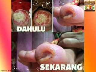 Prepared By ROYAL SWEETENER STEVIA
 