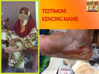 Prepared By ROYAL SWEETENER STEVIA
TESTIMONI
KENCING MANIS
 