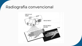 Radiografia convencional
 