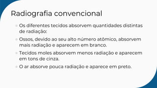 Radiografia convencional
Os diferentes tecidos absorvem quantidades distintas
de radiação:
Ossos, devido ao seu alto número atômico, absorvem
mais radiação e aparecem em branco.
Tecidos moles absorvem menos radiação e aparecem
em tons de cinza.
O ar absorve pouca radiação e aparece em preto.
 