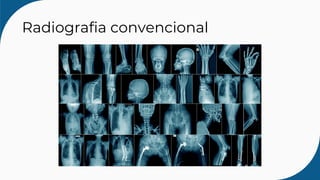 Radiografia convencional
 