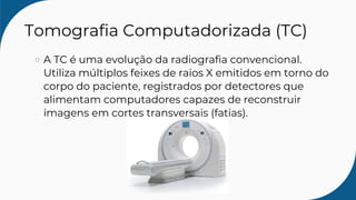 Tomografia Computadorizada (TC)
A TC é uma evolução da radiografia convencional.
Utiliza múltiplos feixes de raios X emitidos em torno do
corpo do paciente, registrados por detectores que
alimentam computadores capazes de reconstruir
imagens em cortes transversais (fatias).
 