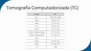 Tomografia Computadorizada (TC)
 