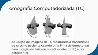 Tomografia Computadorizada (TC)
Aquisição de imagens de TC mostrando a transmissão
de raios no paciente usando uma linha de detector (a),
com rotação do tubo de raios X e detector (b) e por
detector (c).
 