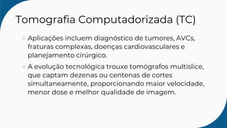 Tomografia Computadorizada (TC)
Aplicações incluem diagnóstico de tumores, AVCs,
fraturas complexas, doenças cardiovasculares e
planejamento cirúrgico.
A evolução tecnológica trouxe tomógrafos multislice,
que captam dezenas ou centenas de cortes
simultaneamente, proporcionando maior velocidade,
menor dose e melhor qualidade de imagem.
 