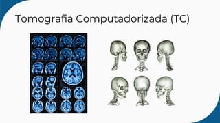 Tomografia Computadorizada (TC)
 