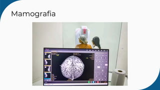 Mamografia
 