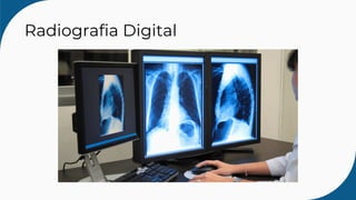 Radiografia Digital
 