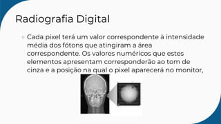 Radiografia Digital
Cada pixel terá um valor correspondente à intensidade
média dos fótons que atingiram a área
correspondente. Os valores numéricos que estes
elementos apresentam corresponderão ao tom de
cinza e a posição na qual o pixel aparecerá no monitor,
 