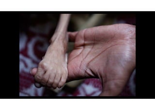 Lembre-se:
Um ambiente de trabalho seguro depende de cada um de nós. Não
devemos deixar nossa saúde a cargo do acaso.
“PORQUE VOCÊ É IMPORTANTE”
SEGURANÇA E SAÚDE
 