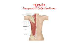 TEKNİK
Preoperatif Değerlendirme
 