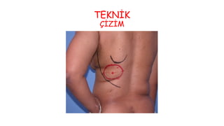 TEKNİK
ÇİZİM
 