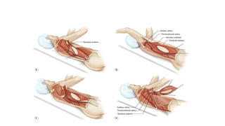 Prof. dr. mehmet ali gülçelik ld flap